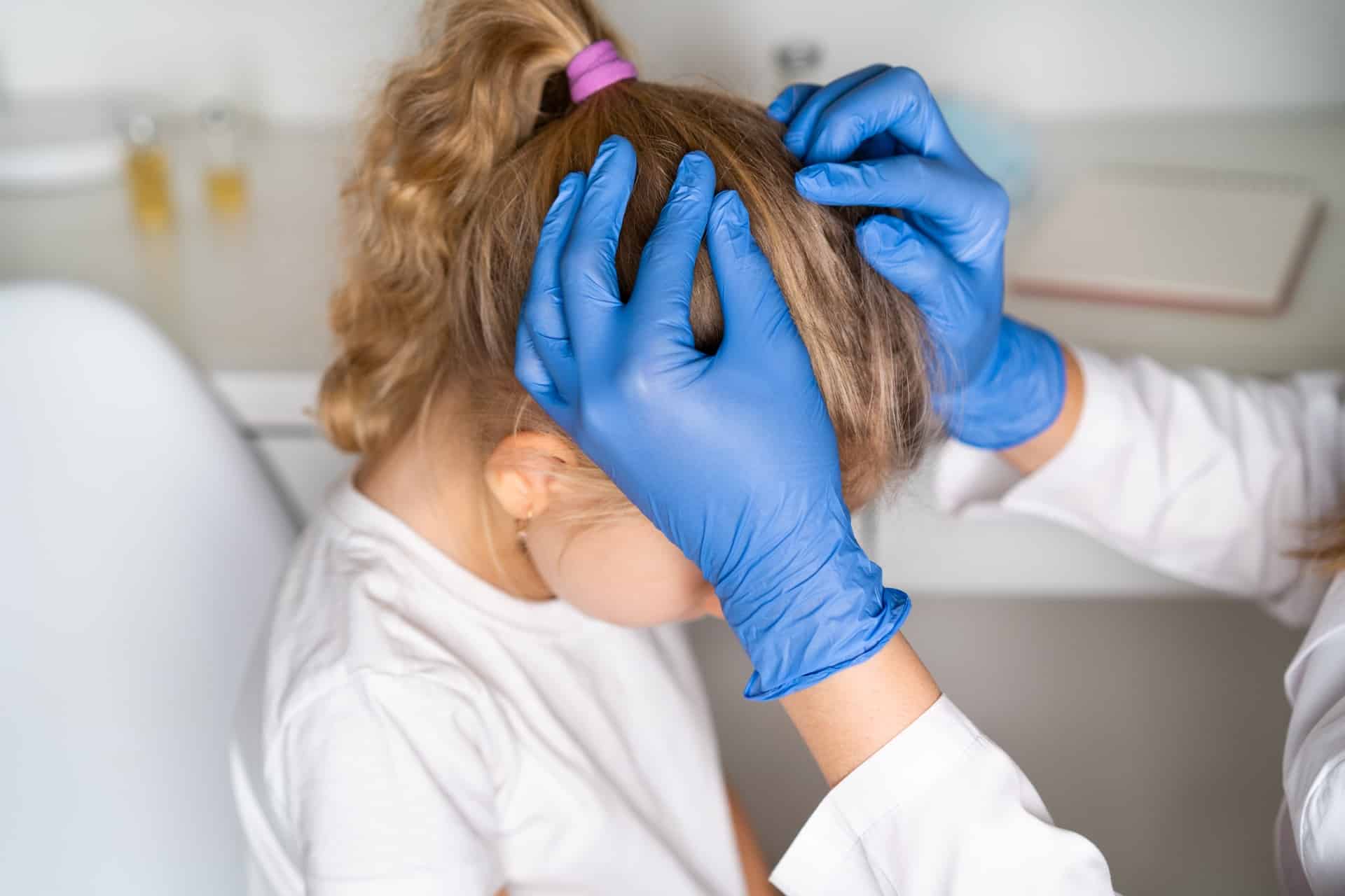 Why Choose Professionals for Lice Removal Expert Insights
